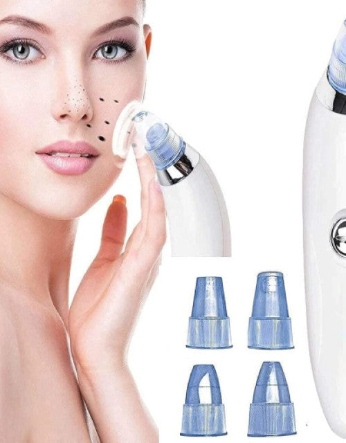 Derma Suction Blackhead Remover Vacuum Pimple Sucker Tool For Men And Women